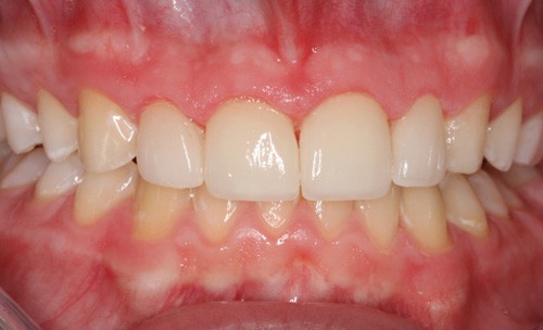 c8-ortho-after